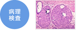 病理検査