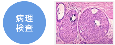 病理検査