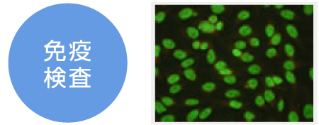 免疫検査